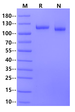 MMP-9 His Tag Protein, Mouse