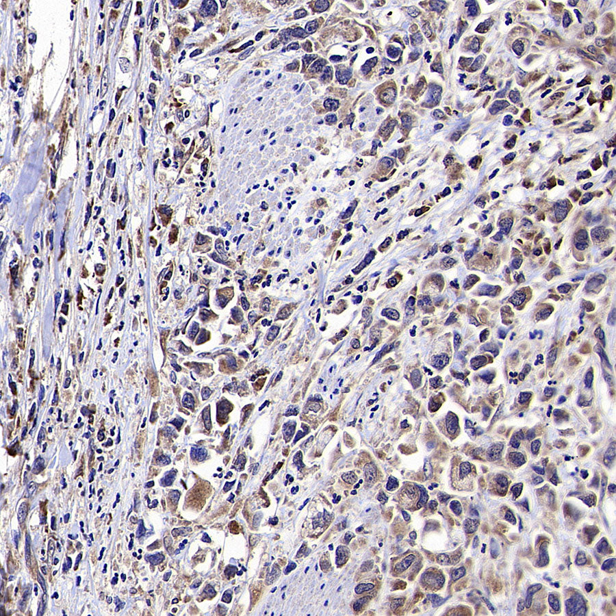 VPS34 Recombinant Rabbit mAb