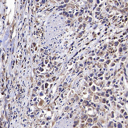 VPS34 Recombinant Rabbit mAb
