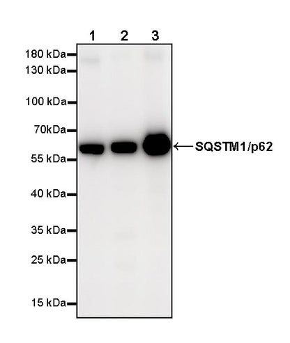 SQSTM1/p62 Recombinant Rabbit mAb (S-R346)