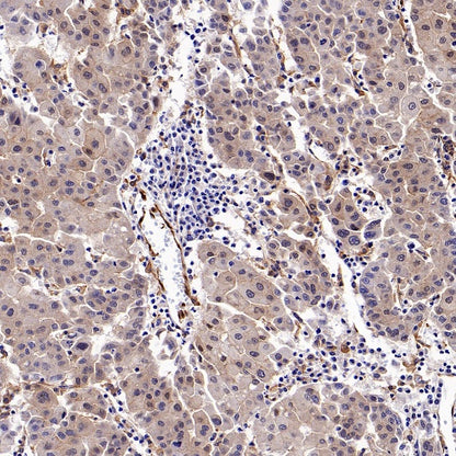 b-FGF/FGF2 Recombinant Rabbit mAb (S-1161-136)
