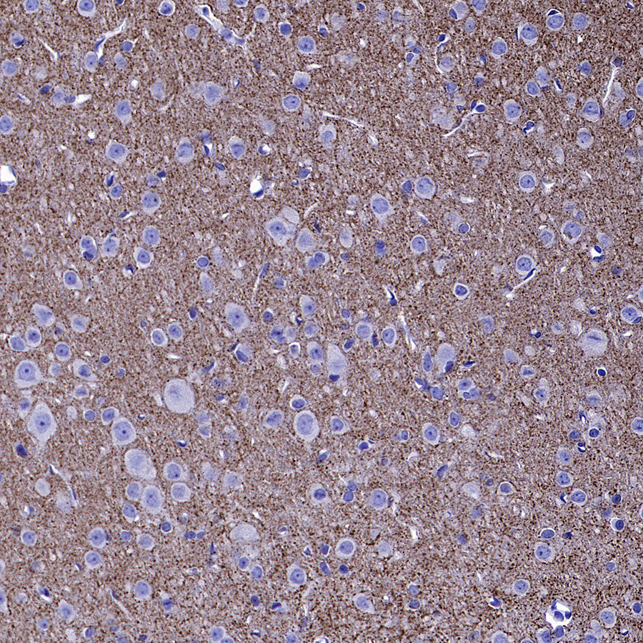 VGLUT2 Recombinant Rabbit mAb (S-4399-14)