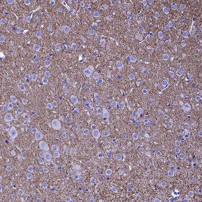 VGLUT2 Recombinant Rabbit mAb (S-4399-14)