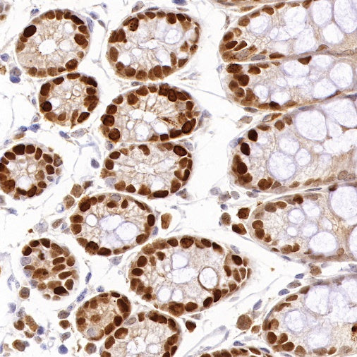 PCNA Recombinant Rabbit mAb (SDT-297-116)
