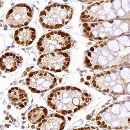 PCNA Recombinant Rabbit mAb (SDT-297-116)