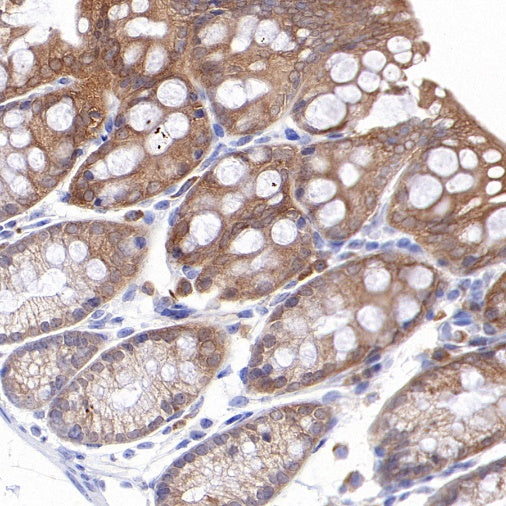 Caspase-7 Recombinant Rabbit mAb (S-782-50)