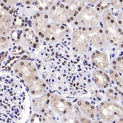 EGR1 Rabbit Polyclonal Antibody