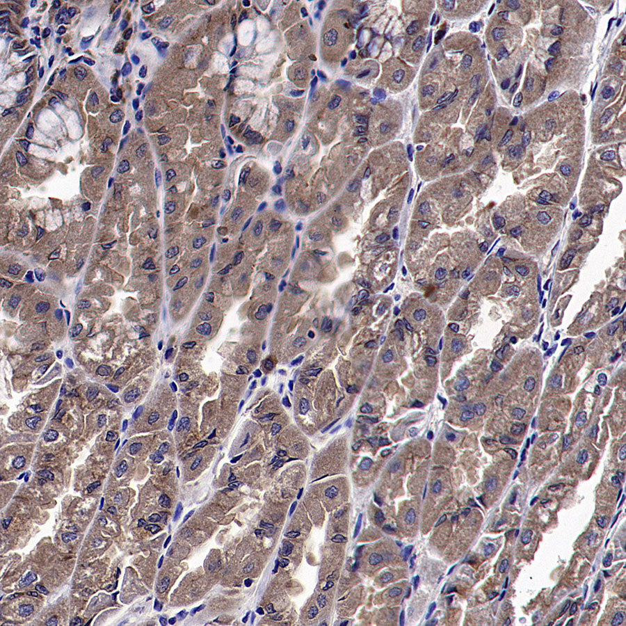 VPS34 Recombinant Rabbit mAb