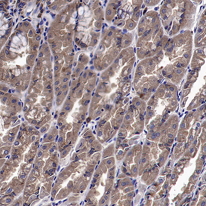 VPS34 Recombinant Rabbit mAb