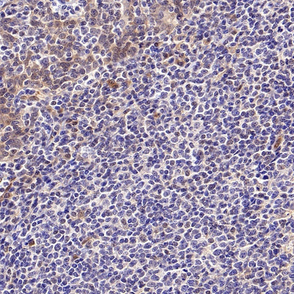 SMAD1 Rabbit Polyclonal antibody