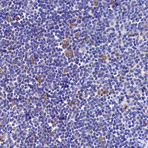 Hemoglobin alpha Recombinant Rabbit mAb (S-R242)