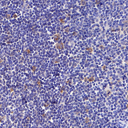 Hemoglobin alpha Recombinant Rabbit mAb (S-R242)