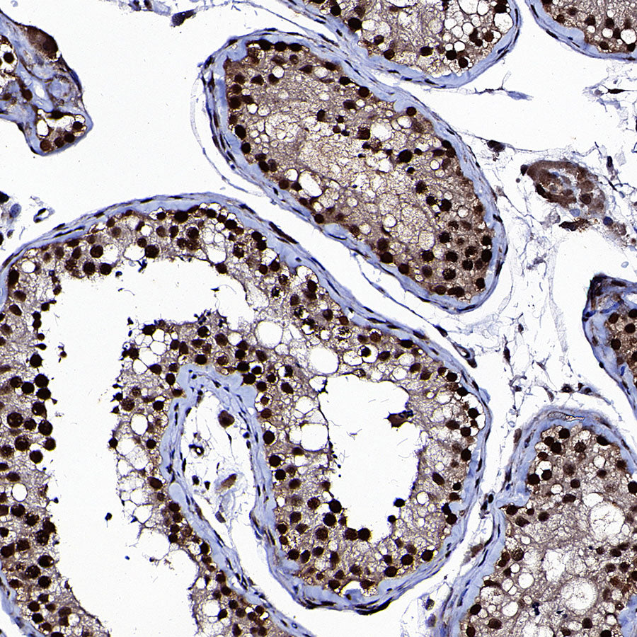 SAE1 Rabbit Polyclonal Antibody