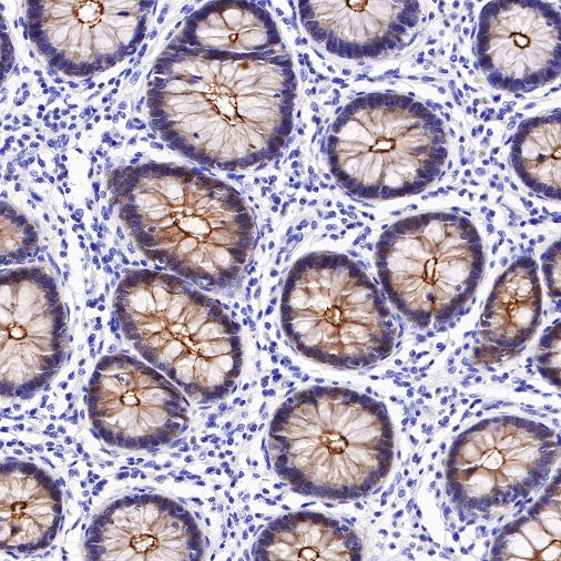 Villin Recombinant Rabbit mAb (SDT-R255)