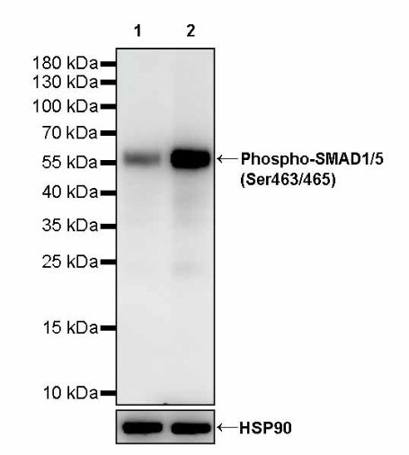 Phospho-SMAD1/5 (Ser463/465) Recombinant Rabbit mAb (S-4058)