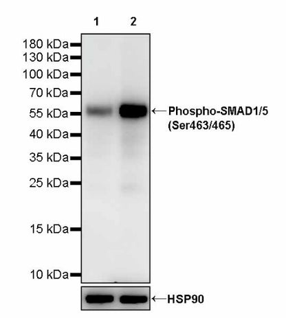 Phospho-SMAD1/5 (Ser463/465) Recombinant Rabbit mAb (S-4058)