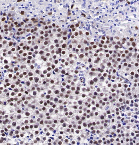 SOX17 Recombinant Rabbit mAb (SDT-1803-48)