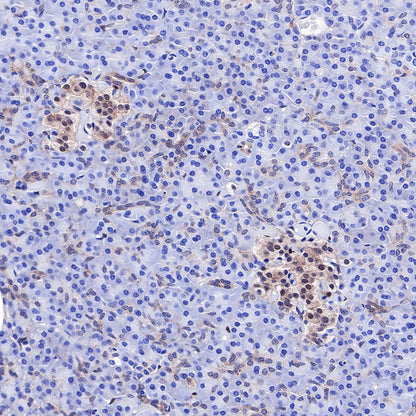 S-RMab® PTEN Recombinant Rabbit mAb (SDT-R069)