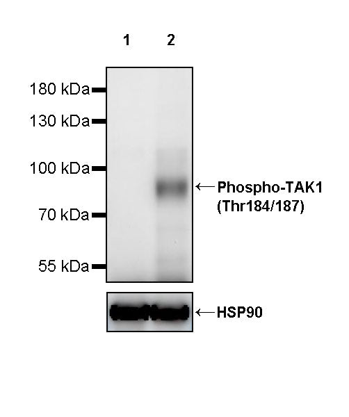 Phospho-TAK1 (Thr184/187) Recombinant Rabbit mAb (S-4146)