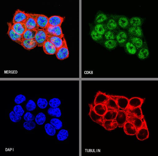 CDK8 Recombinant Rabbit mAb (S-1627-70)
