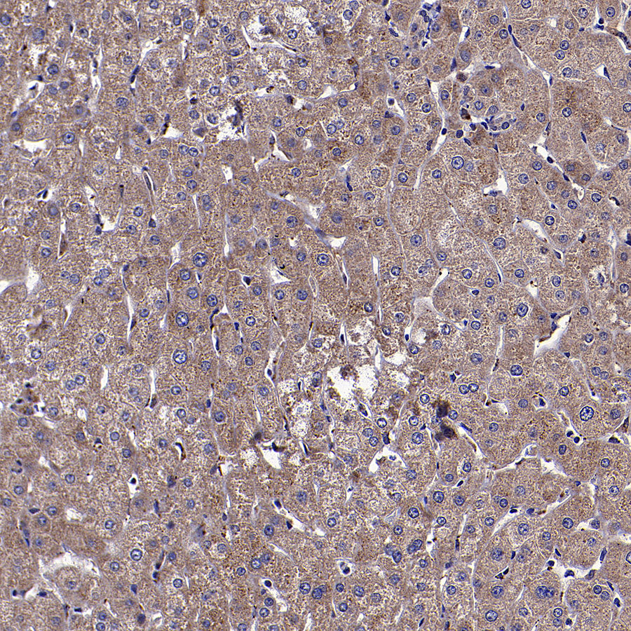 ClpX Recombinant Rabbit mAb (S-4460-33)