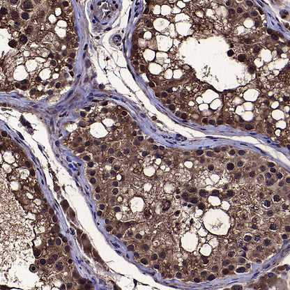 DOCK11 Recombinant Rabbit mAb (S-4420-57)