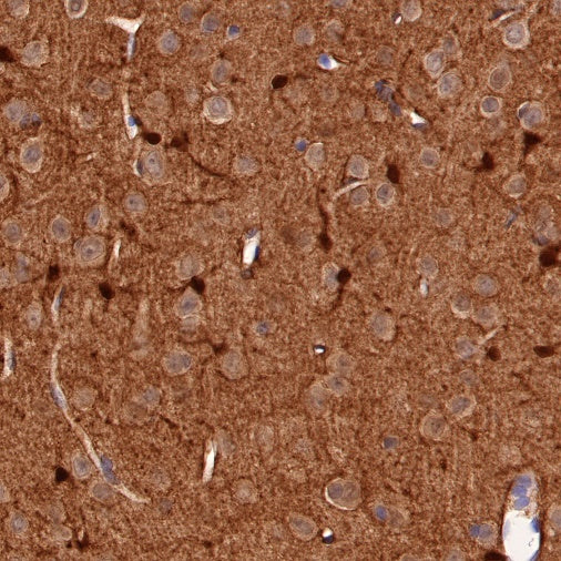 S-RMab® S100B Recombinant Rabbit mAb (SDT-518-45)