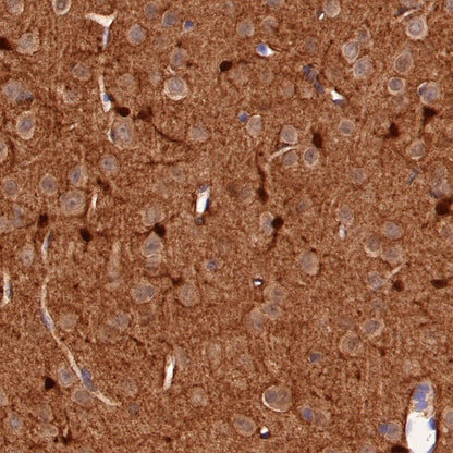 S-RMab® S100B Recombinant Rabbit mAb (SDT-518-45)