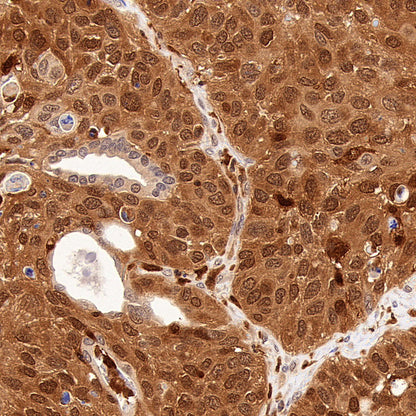GRB2 Recombinant Rabbit mAb (S-5948)