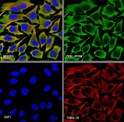 PFKL+PFKM Recombinant Rabbit mAb (S-1302-31)