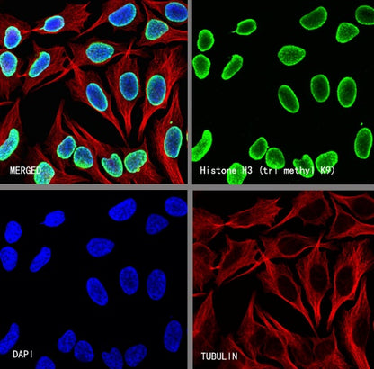 Histone H3 (tri methyl K9) Recombinant Rabbit mAb (S-3826)