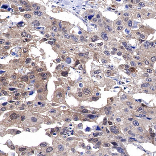 SH-PTP2 Recombinant Rabbit mAb (S-1318-2)