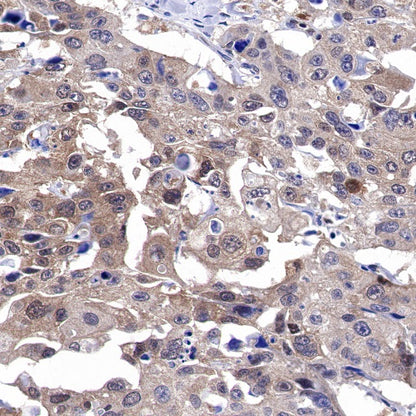 SH-PTP2 Recombinant Rabbit mAb (S-1318-2)