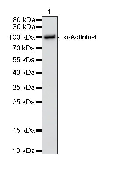 α-Actinin-4 Recombinant Rabbit mAb