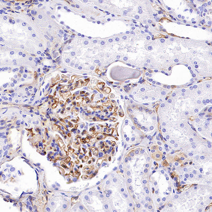 HLA-ABC Recombinant Rabbit mAb (S-3995-2)