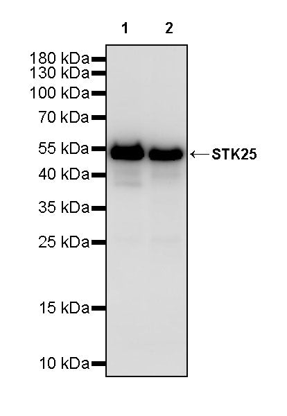 STK25 Recombinant Rabbit mAb (S-4088-17)