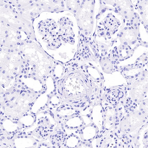 IKAROS Recombinant Rabbit mAb (S-R264)