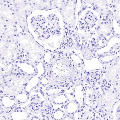 IKAROS Recombinant Rabbit mAb (S-R264)