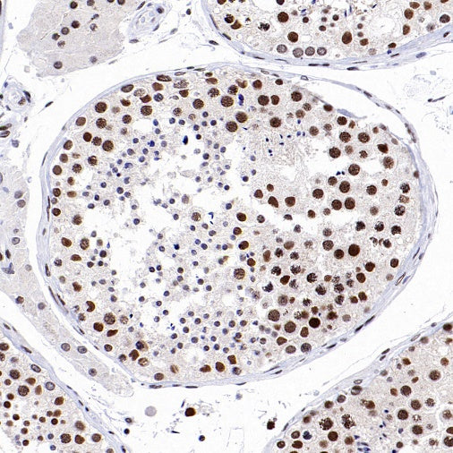 SIRT1 Recombinant Rabbit mAb (S-1886-15)