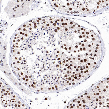 SIRT1 Recombinant Rabbit mAb (S-1886-15)