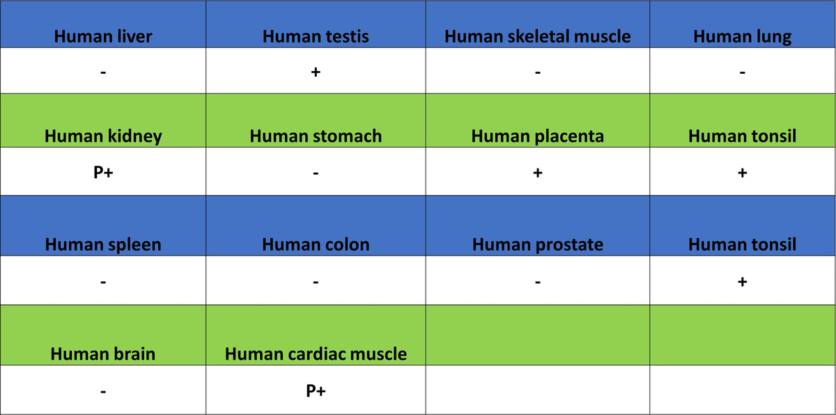 Cyclin E1 Recombinant Rabbit mAb (SDT-4375-44)