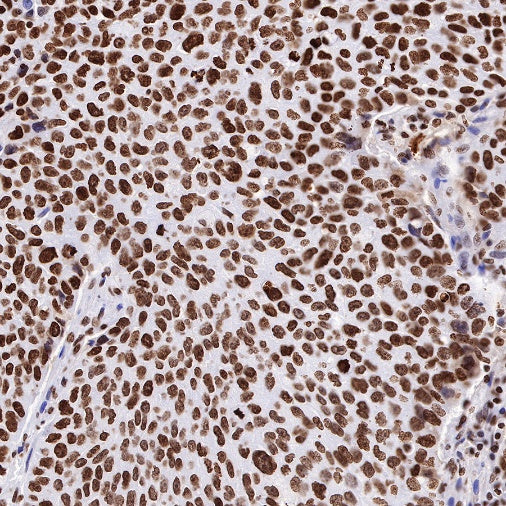 Histone H3 (mono methyl K36) Recombinant Rabbit mAb (S-R211)