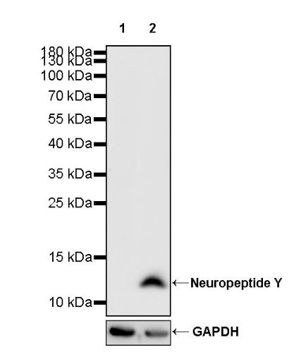 Neuropeptide Y Recombinant Rabbit mAb (S-1104-18)