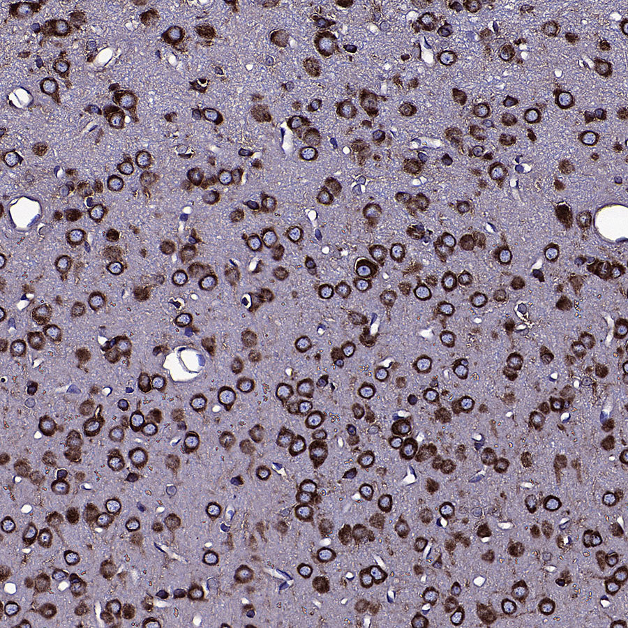CAPRIN1 Mouse mAb