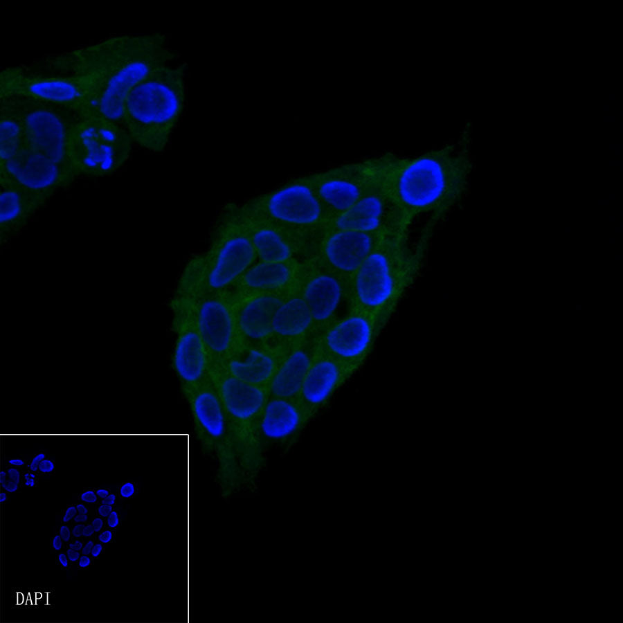 Glypican-3 Recombinant Rabbit mAb,PBS Only (SDT-R032)