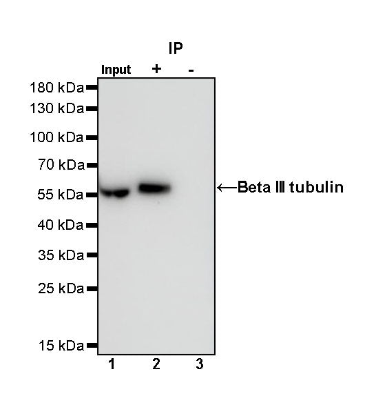 Beta III tubulin Recombinant Rabbit mAb (SDT-251-28)