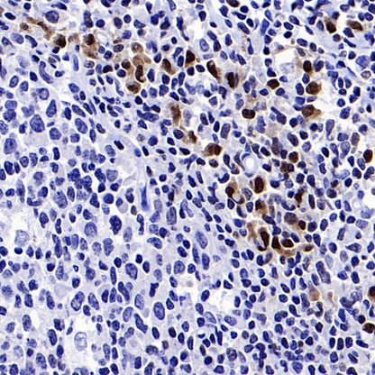 Runx2 Recombinant Rabbit mAb (S-1767-173)
