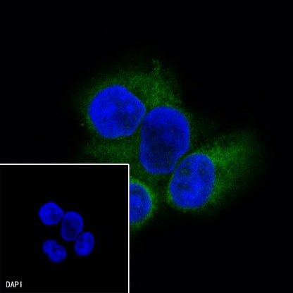 ALDH3A1 Recombinant Rabbit mAb (S-R220)