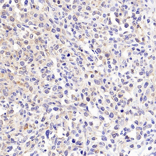 Jak3 Recombinant Rabbit mAb (S-4219)