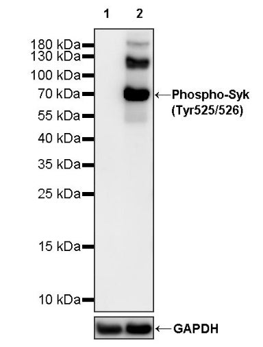 Phospho-Syk (Tyr525/526) Recombinant Rabbit mAb (S-1245-113)